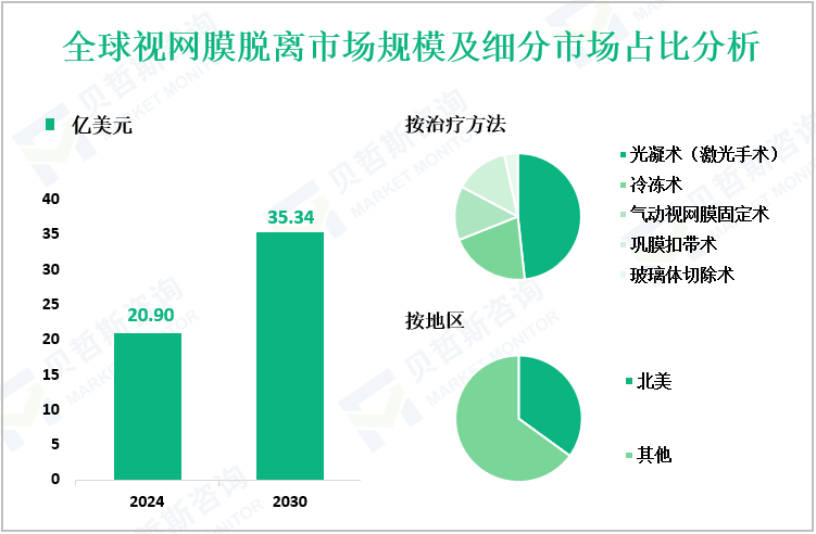 全球视网膜脱离市场规模及细分市场占比分析