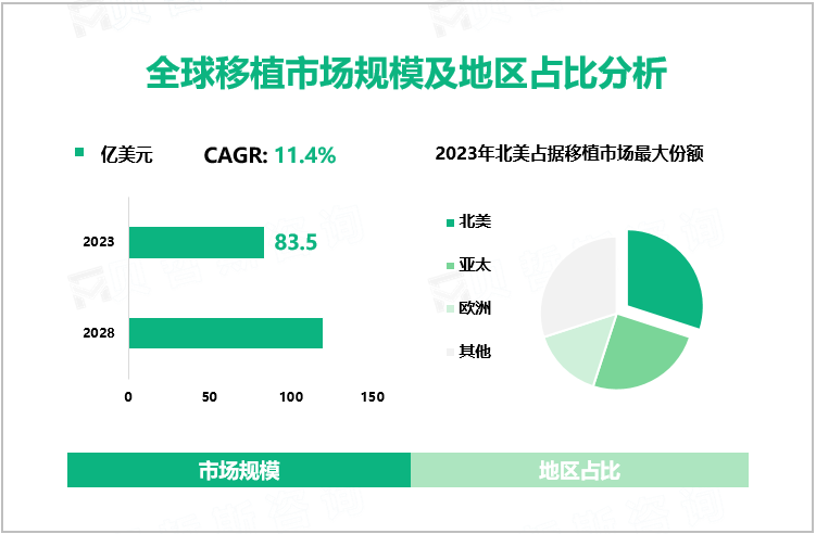 全球移植市场规模及地区占比分析